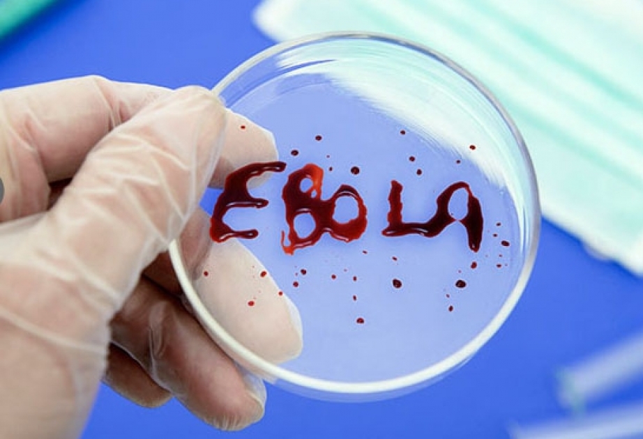Rusiyada ebola aşkarlanıb