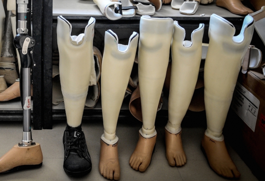 Yeni ayaq protezi sınaq mərhələsindədir
