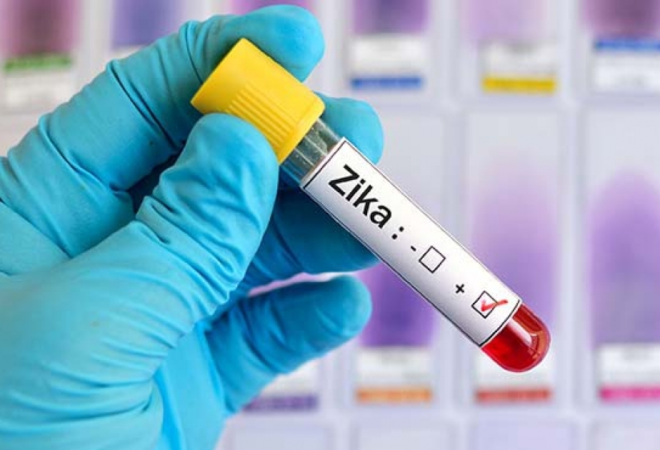 Amerikalı alimlər Zika virusu əleyhinə vaksinin sınaqlarına başlayacaqlar