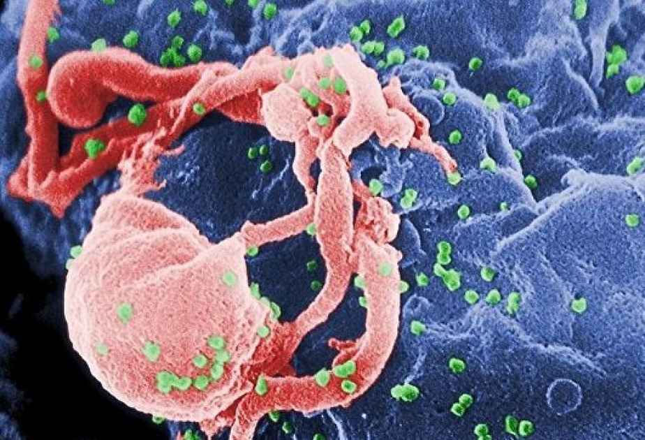 Ученые из США вырастили первых обезьян с иммунитетом к ВИЧ