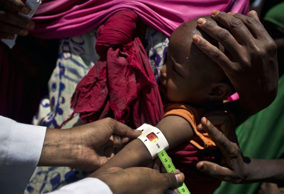 ООН приходит на помощь голодающим сомалийским детям