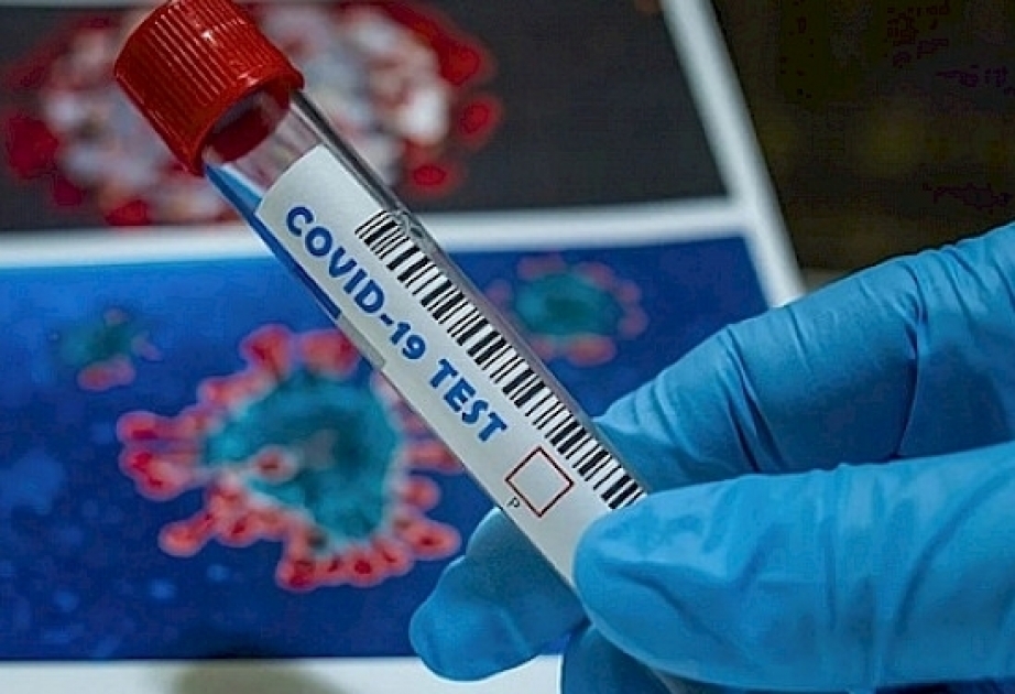 L'Ouzbékistan compte au total près de 31 mille cas de contamination au coronavirus
