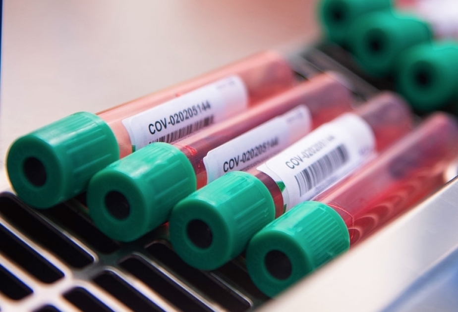 ÜST: COVID-19-la mübarizə üçün 200 vaksin kliniki və klinikəqədərki sınaqlar mərhələsindədir