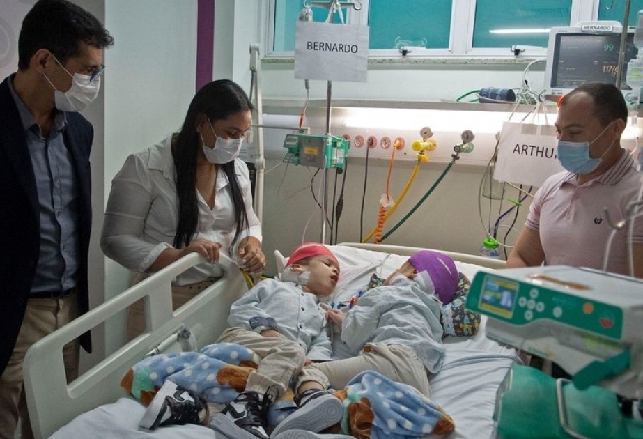 In Brasilien trennen Ärzten die dreijährigen siamesischen Zwillinge