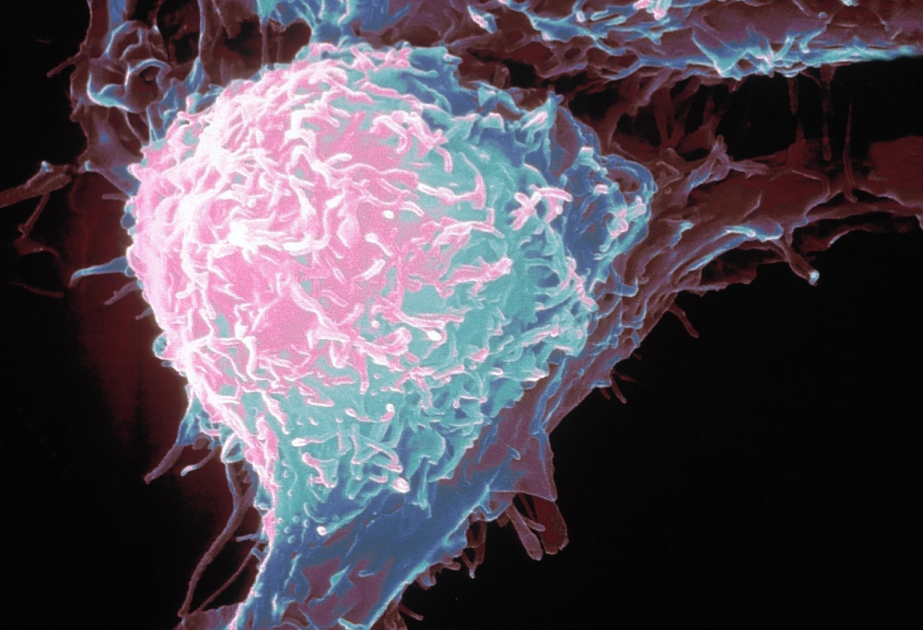 Was verursacht Krebs im Körper?