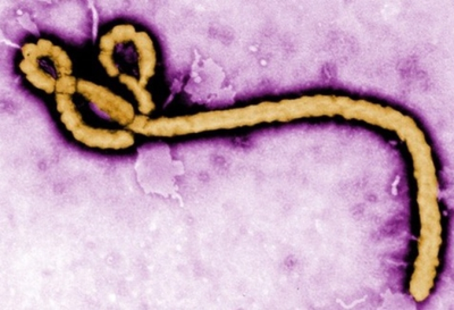 Rumıniya vətəndaşı Ebola virusunun simptomları ilə xəstəxanaya yerləşdirilib