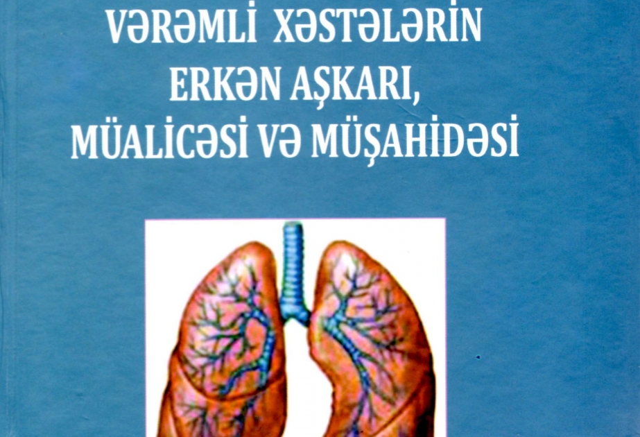 “Vərəmli xəstələrin erkən aşkarı, müalicəsi və müşahidəsi” kitabı çapdan çıxıb