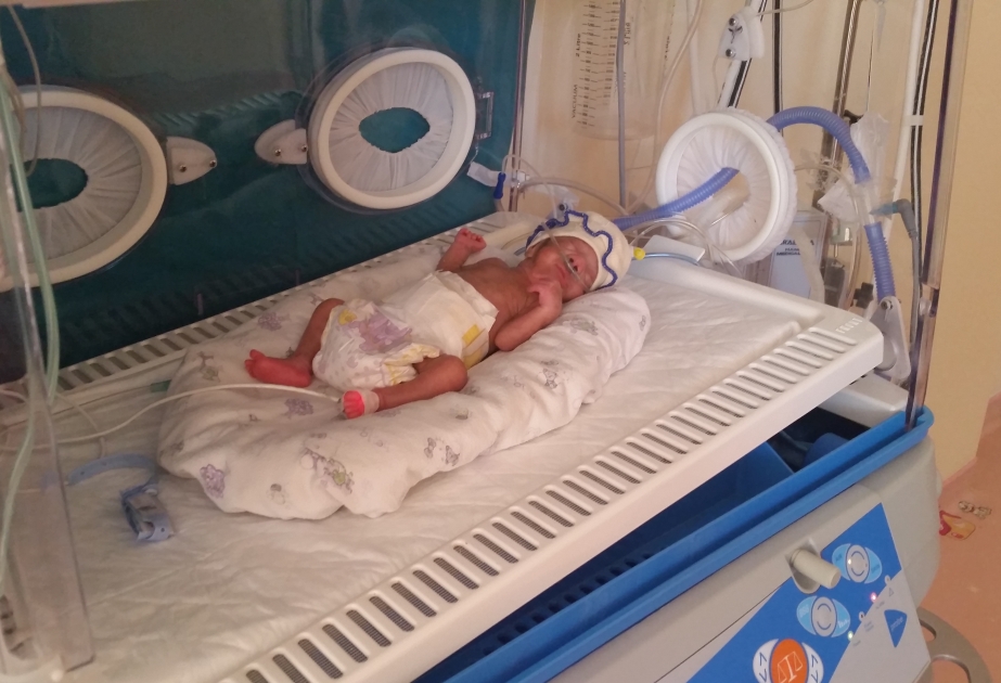 Tədris Cərrahiyyə Klinikasında 650 qram çəki ilə dünyaya gələn körpə yaşayır