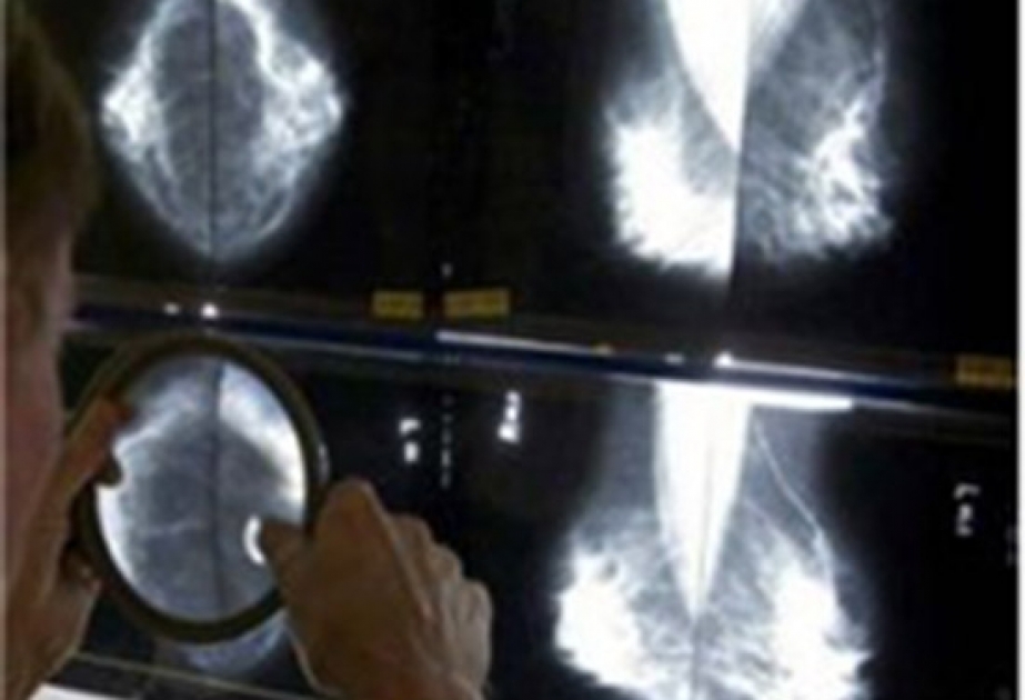 Онкологи США изменили мнение о маммографии