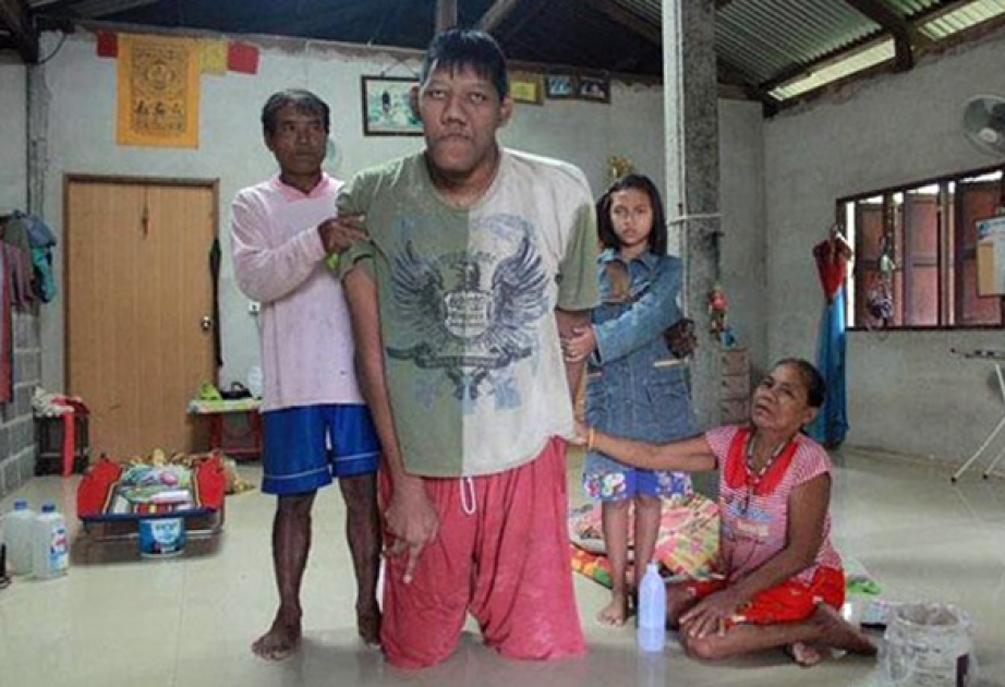 World's tallest man dies in Surin