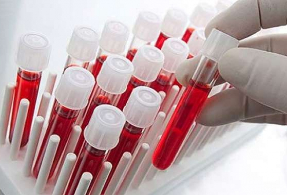 İtaliya viruslara yoluxmuş 350-dən çox insana 10 milyon avro kompensasiya ödəyəcək