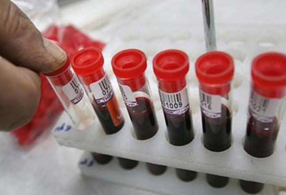 Son 9 ayda nikaha girmək istəyən 107 min 500 nəfər tibbi müayinədən keçib