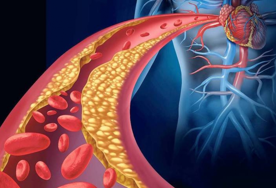 Viel HDL-Cholesterin im Blut erhöht Risiko für Herzkrankheiten