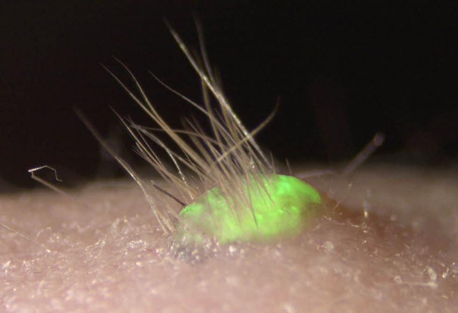 Forscher produzieren Haut mit Haaren