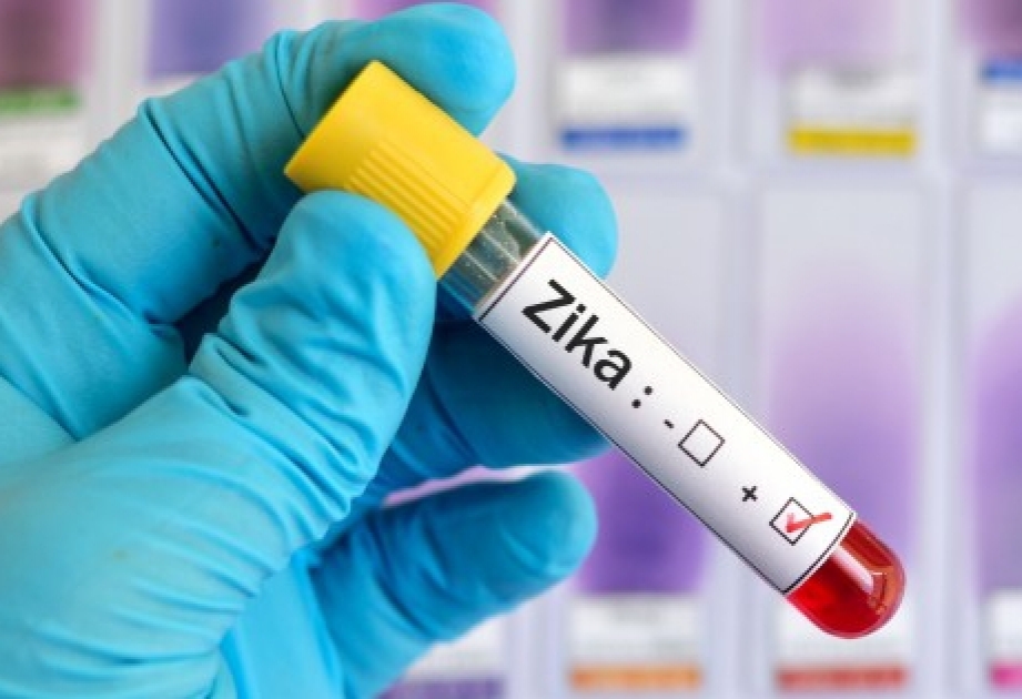 В США впервые скончался пациент с вирусом Зика