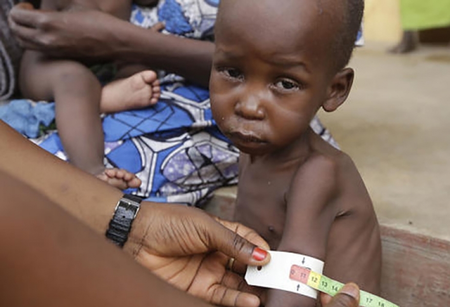 Nigeria: 400 000 Kinder vom Hungertod bedroht