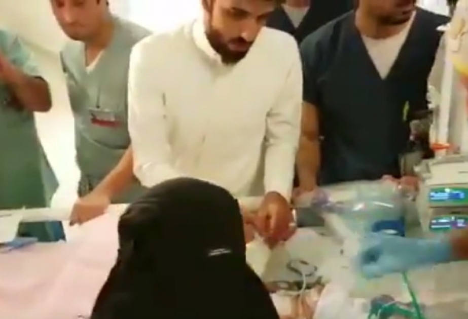 Саудовские врачи успешно разделили сиамских близнецов