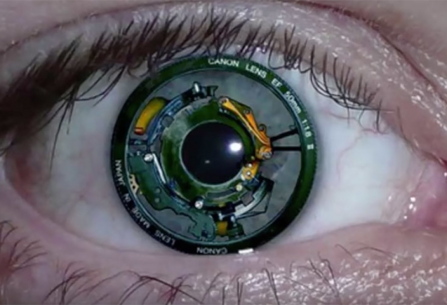 Görmə əngəllilər üçün “bionik göz”