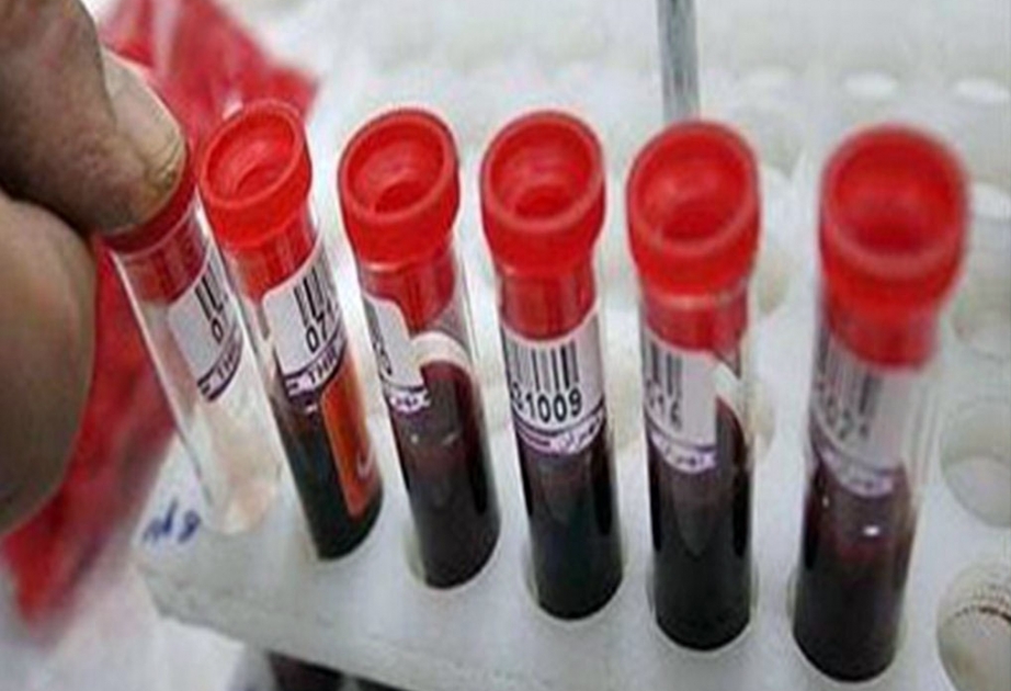 Свыше 207 700 человек прошли медицинское обследование для вступления в брак ВИДЕО