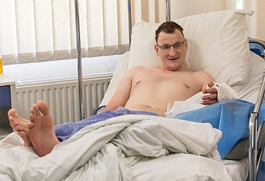 В Польше впервые пересадили руку взрослому мужчине, родившемуся без нее