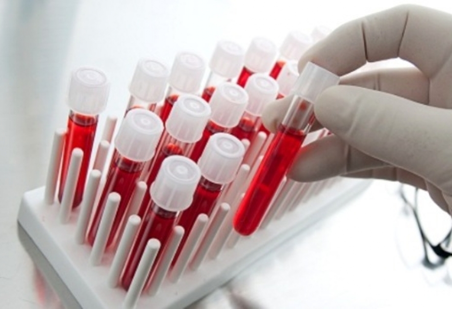 Beyləqanda yeni ailə quran 1419 nəfər tibbi müayinə olunub