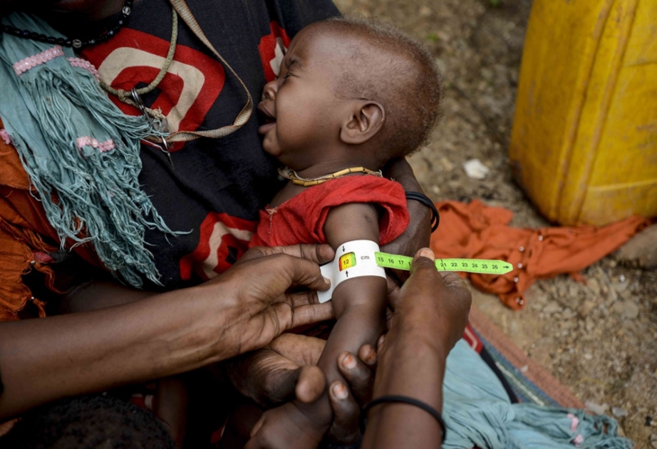 Антониу Гутерриш: в мире изобилия не может быть никакого оправдания голоду в Африке
