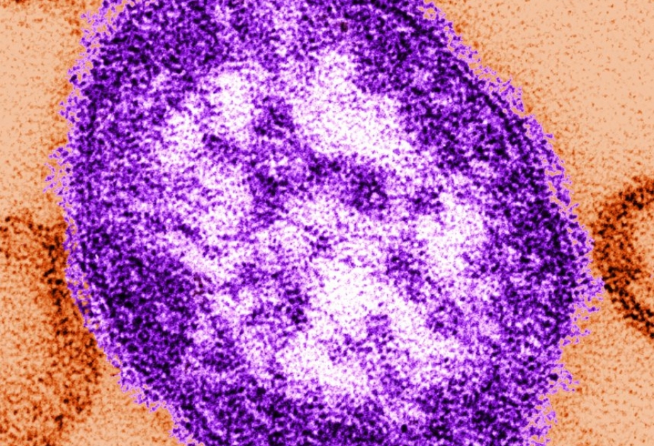 WHO: Gefährliches Virus in Europa