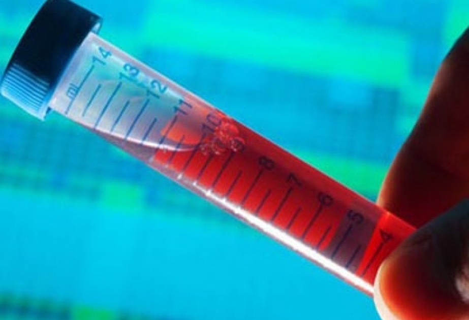 8 may-Beynəlxalq Talassemiya Günüdür