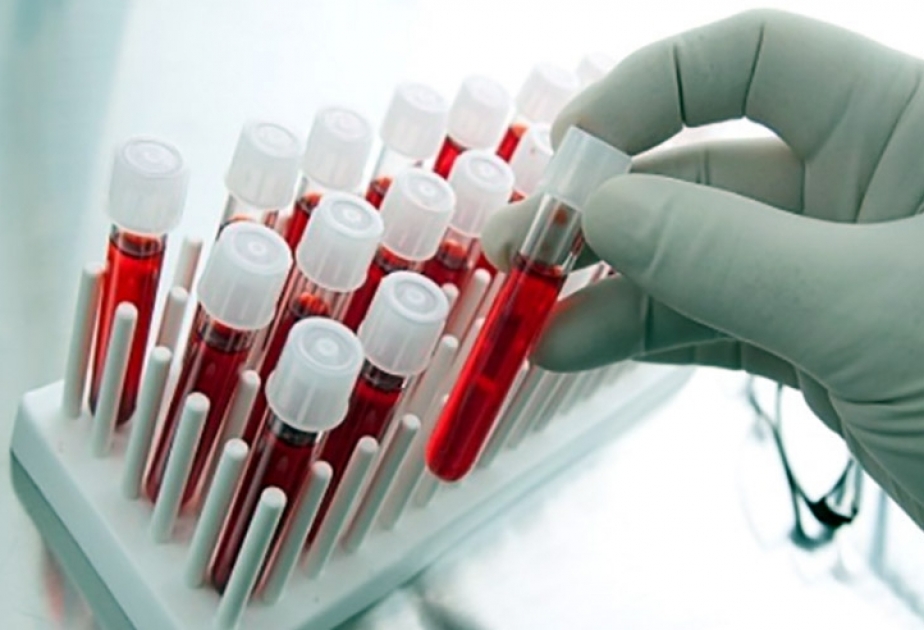 Xaçmazda keçirilən humanitar aksiyada 100-dən çox donor könüllü qan verib VİDEO