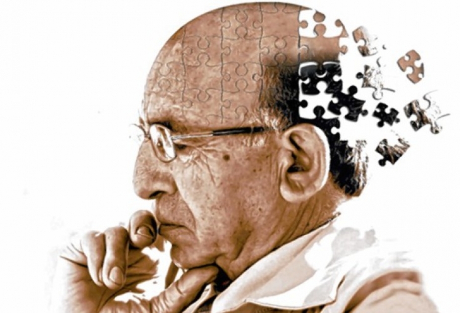 Болезнь Альцгеймера не всегда зарождается в мозге