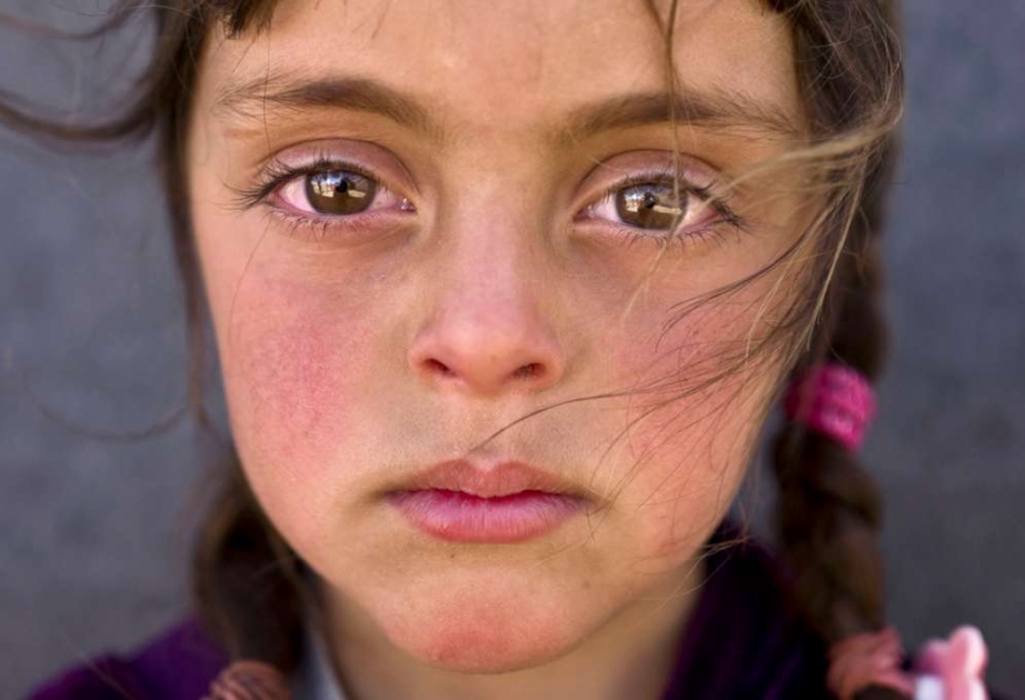 Trauriger Blick: Unicef-“Foto des Jahres“ zeigt syrisches Flüchtlingsmädchen