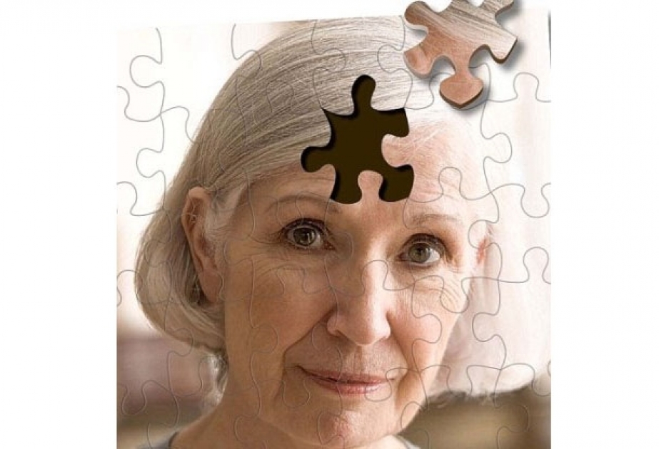 Учёные заявили об эффективном средстве от болезни Альцгеймера