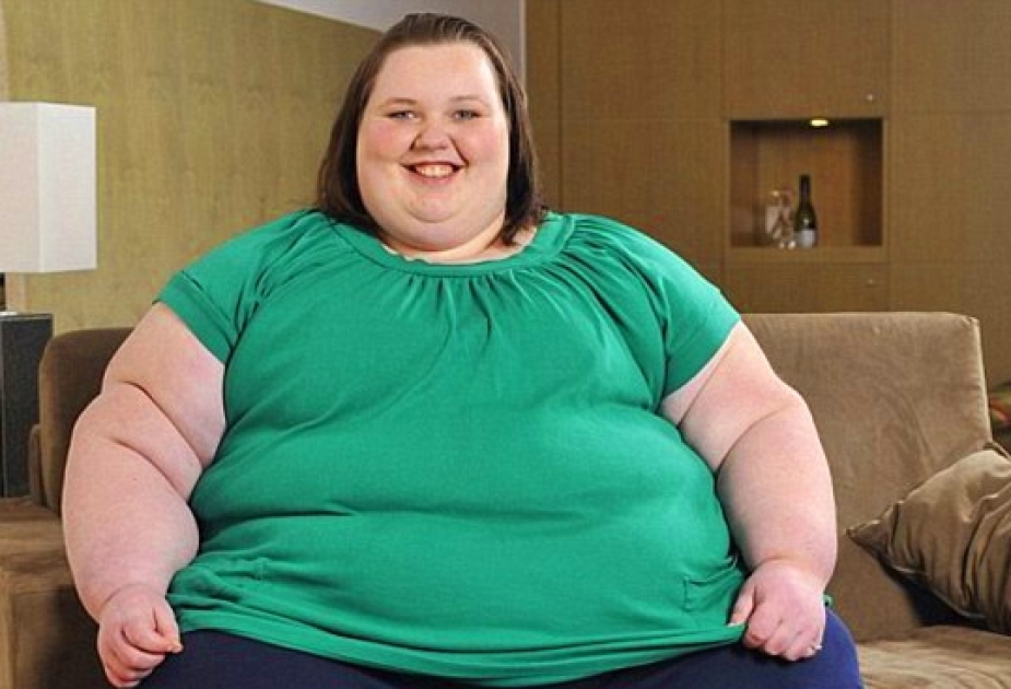 Ожирение связали с генетическими мутациями