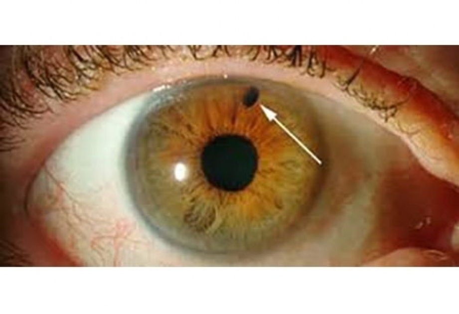 Seks multfilmlar Scooby Du Fred va Daphne