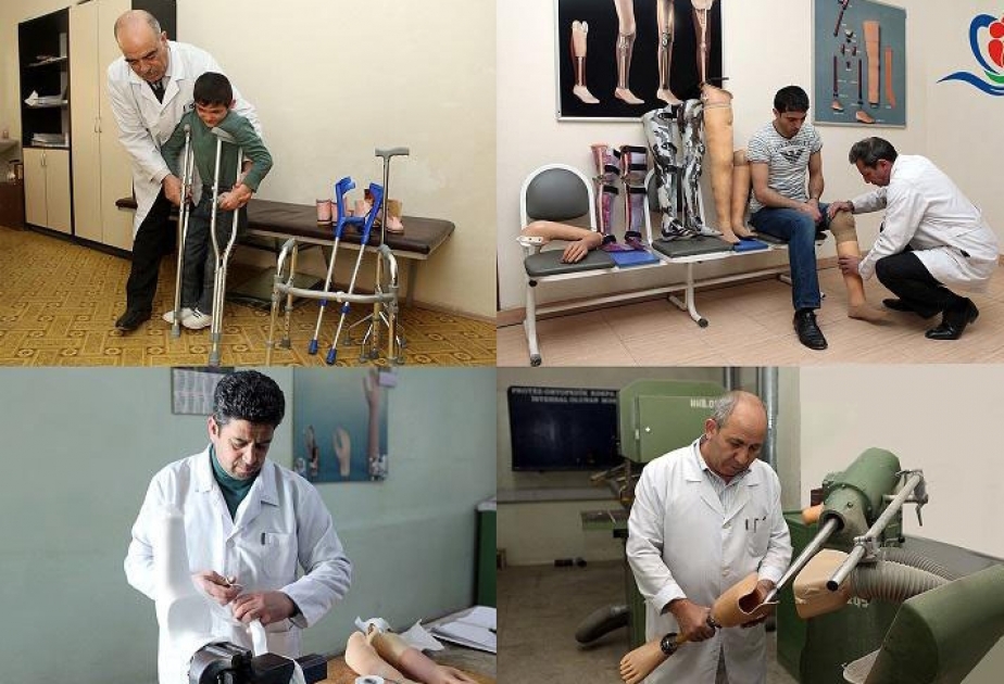 За январь-февраль инвалиды обеспечены 4 243 единицами протезно-ортопедических изделий и реабилитационных средств