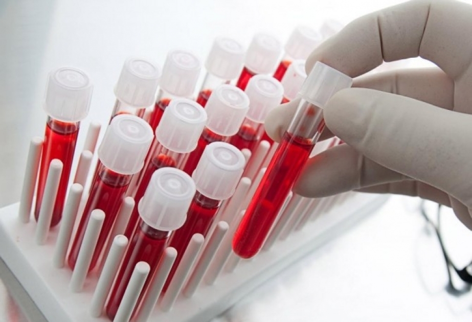 Учеными разработан анализ крови, определяющий вероятность развития туберкулеза