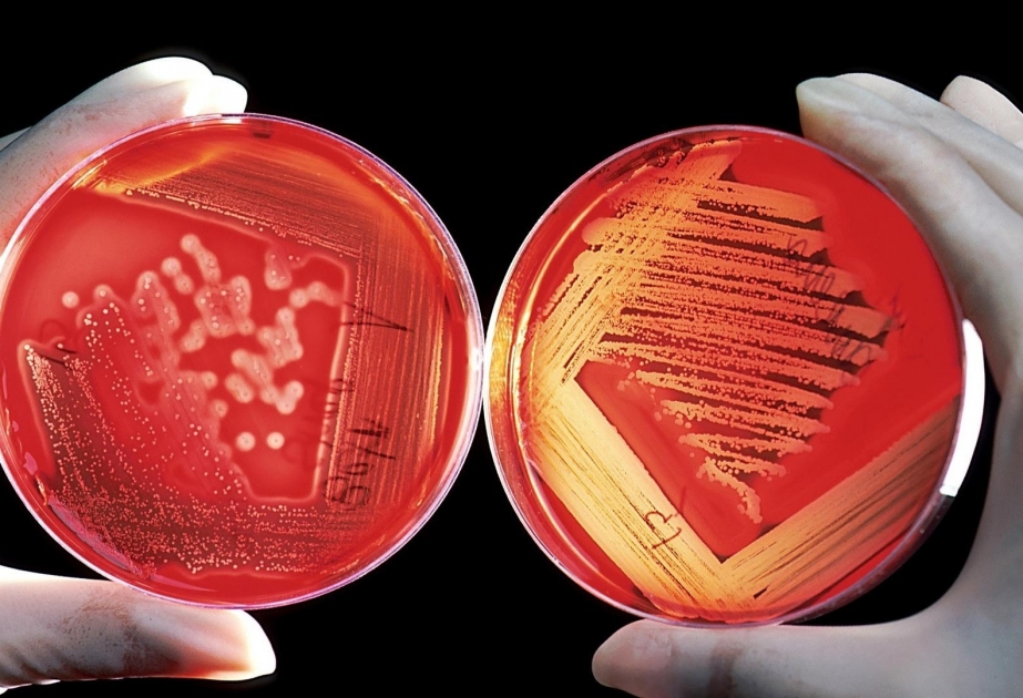 Alimlər herpes xəstəliyini aradan qaldıran DNT vaksini hazırlayıb