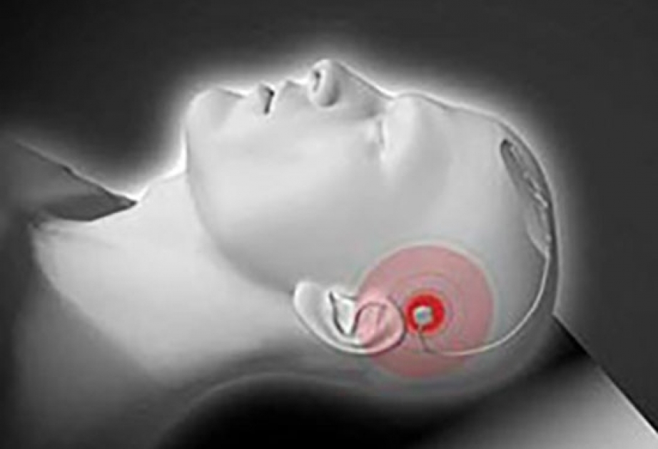 Nadir implantat Parkinson xəstəliyinin əlamətlərinin öhdəsindən gələcək