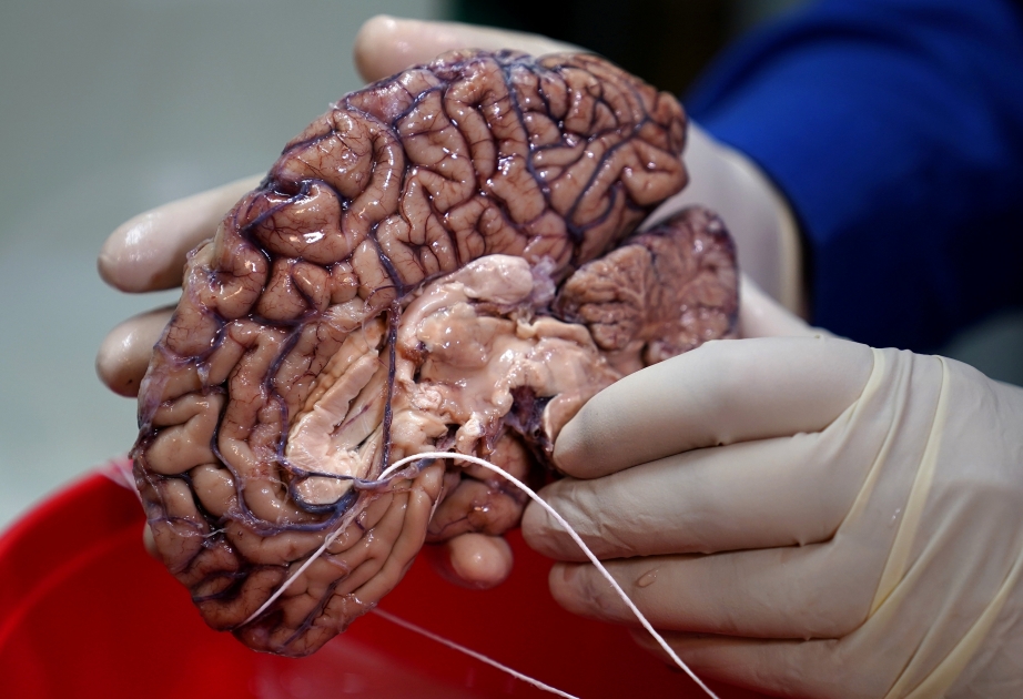 İnsanın böyük beynində genlər araşdırılır