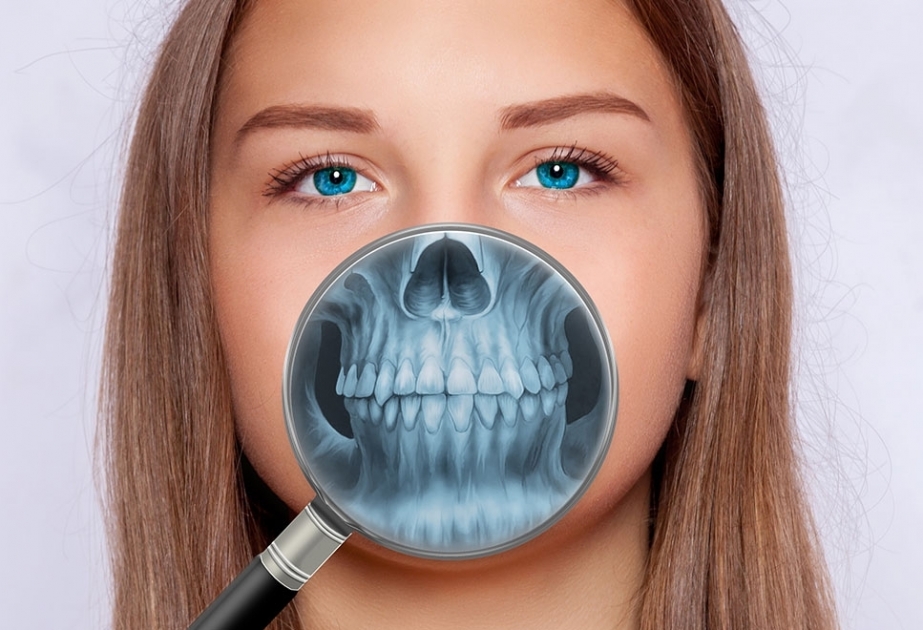Baku to host international conference of oral and maxillofacial surgery