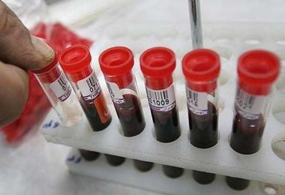 Lerikdə humanitar aksiya: 147 nəfər könüllü qan verib