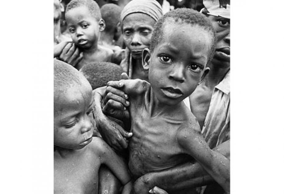 Save the Children: Babys-Körper ausgemergelt vom Hunger"