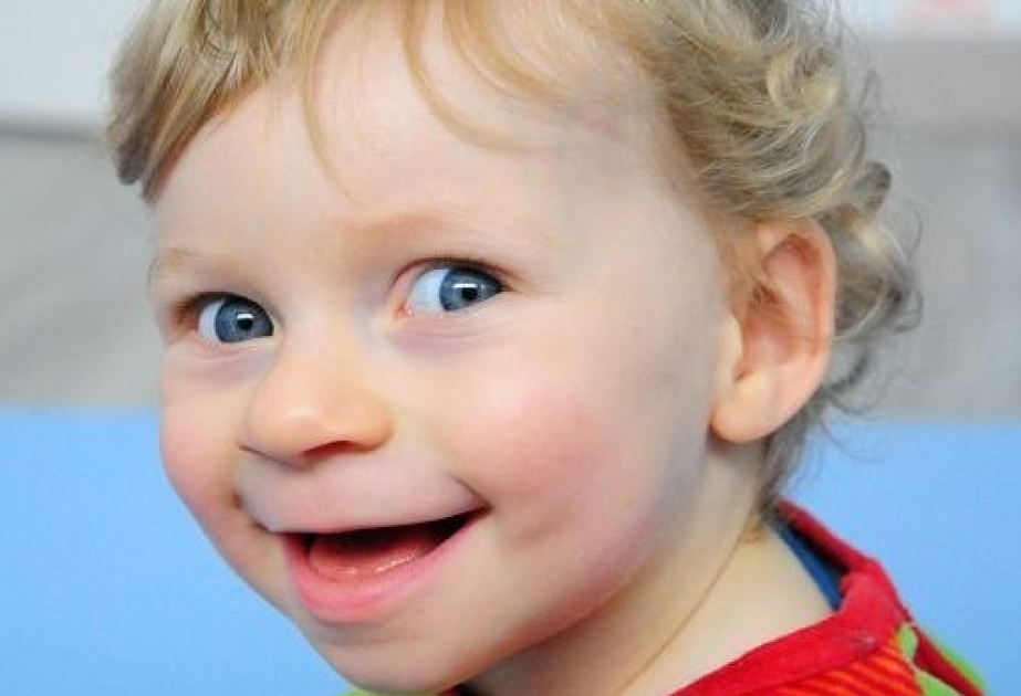 Синдром счастливой куклы фото детей