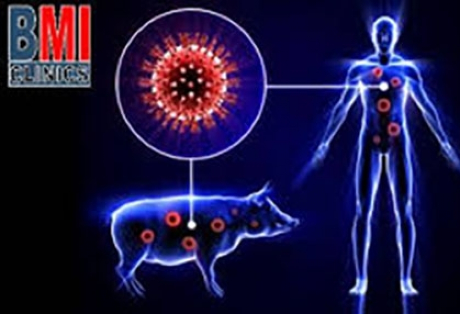 Gürcüstanda bir nəfər H1N1 virusundan dünyasını dəyişib