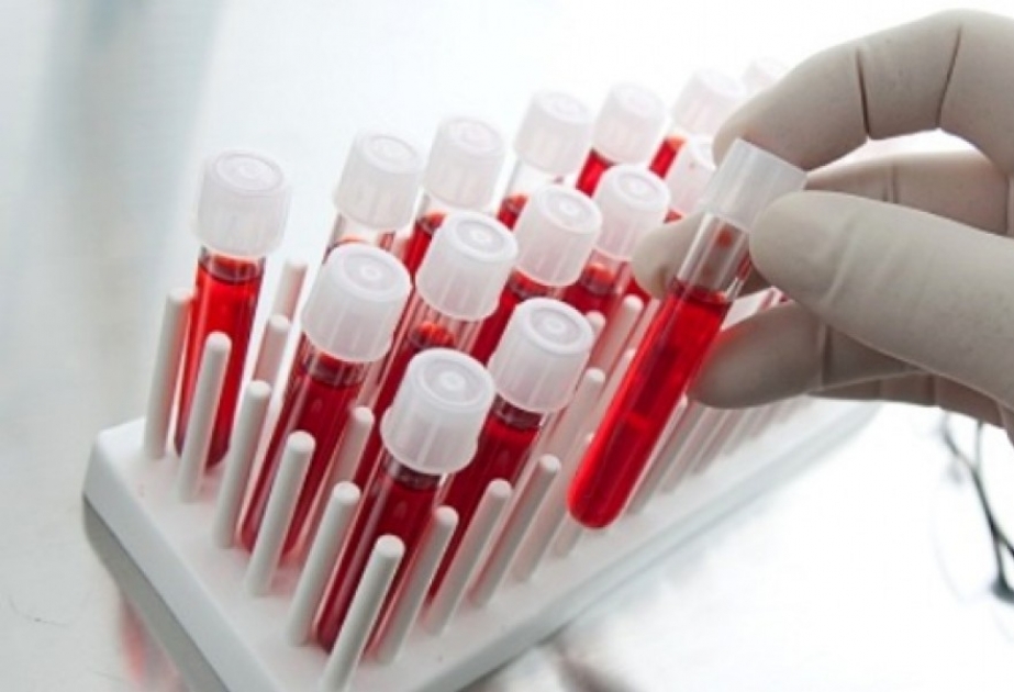 Beyləqanda yeni ailə quran 1413 nəfər tibbi müayinədən keçib