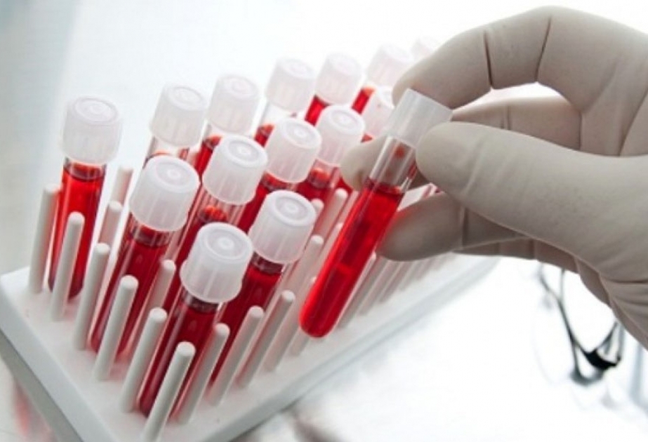 Ötən il Ağcabədidə yeni ailə qurmaq istəyən 22 nəfərdə talassemiya xəstəliyinin daşıyıcısı aşkarlanıb