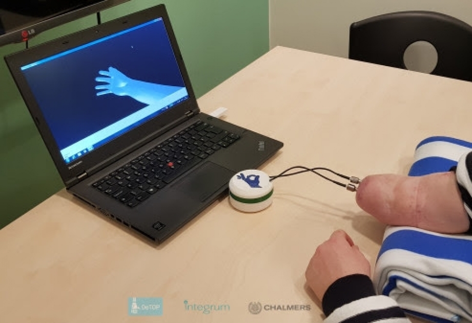 В Швеции разработали протезную руку, способную обеспечить пациентов чувствами обычных конечностей
