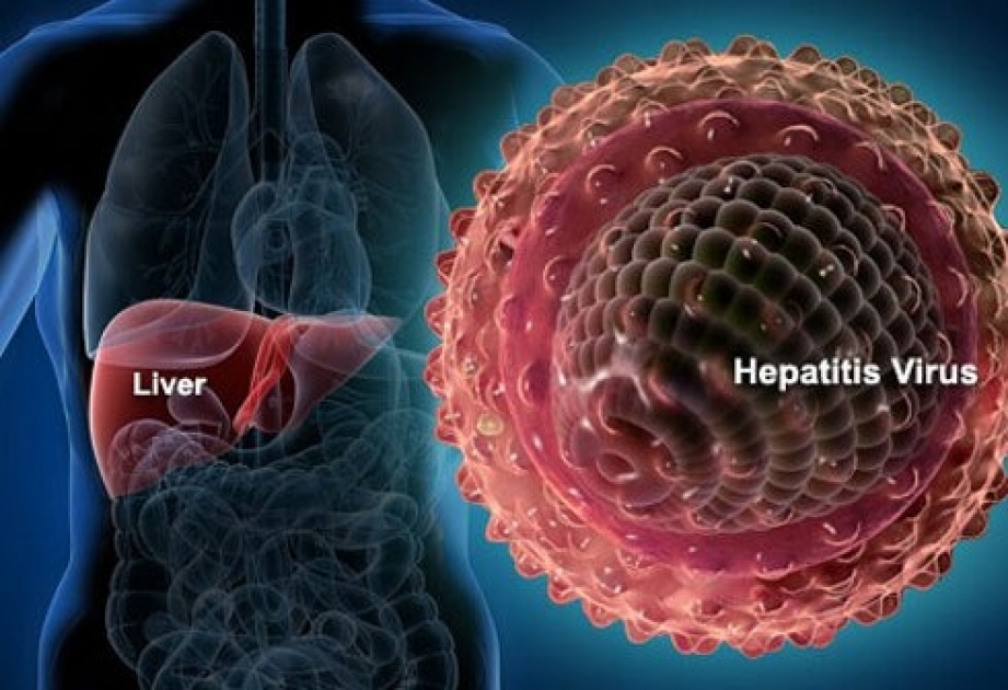 Gürcüstanda 150 min hepatit C xəstəsi var