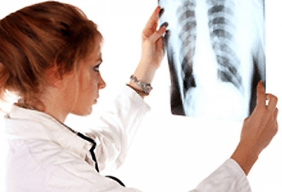 24 de marzo: Día Mundial de la Tuberculosis, ¿qué sabes de esta enfermedad?