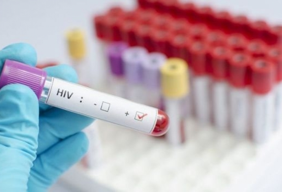 Ученые в США рассказали о новом методе лечения ВИЧ